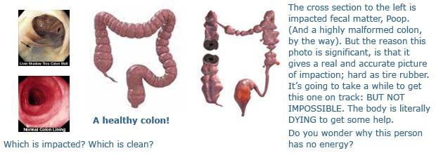 colon health